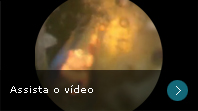 Assista o v&iacute;deo